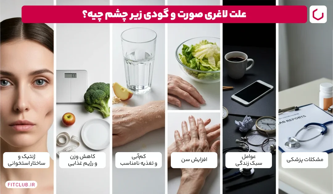 علت لاغری صورت و گودی زیر چشم چیست؟ | فیت کلاب