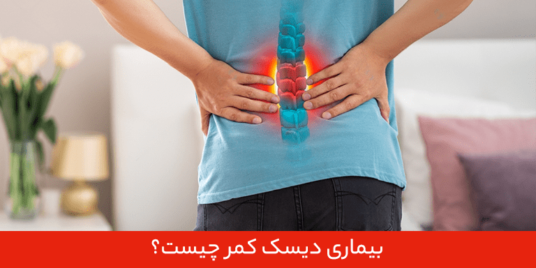 دیسک کمر چیست و چه علائمی دارد؟ ورزش برای دیسک کمر خوب است یا بد