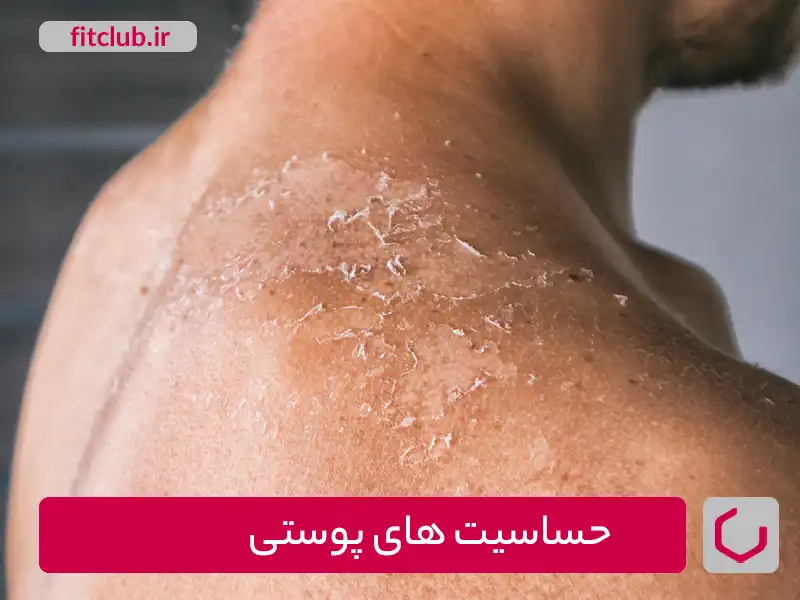 حساسیت های پوستی معایب استفاده از ژل لاغری