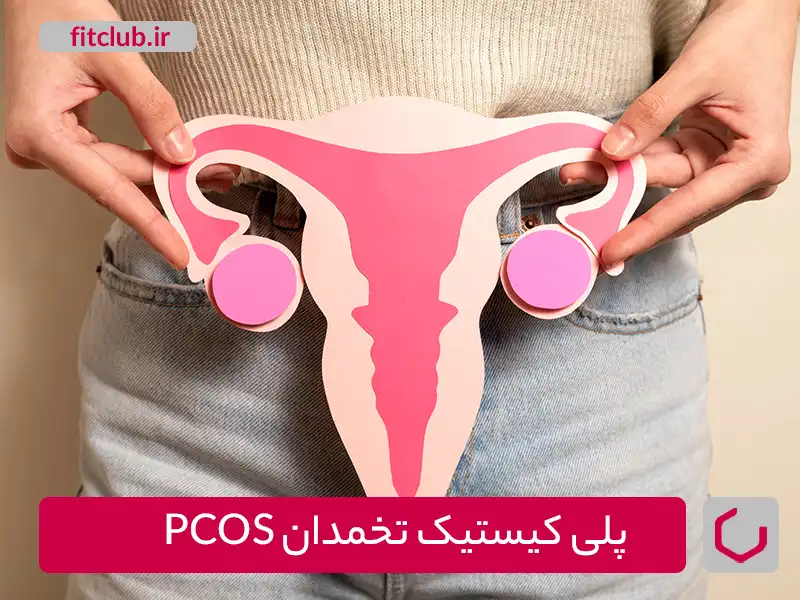 پلی‌کیستیک تخمدان PCOS ، یکی از انواع اختلالات هورمونی زنانه