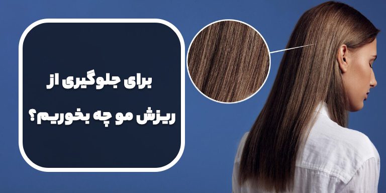 برای جلوگیری از ریزش مو چه بخوریم؟