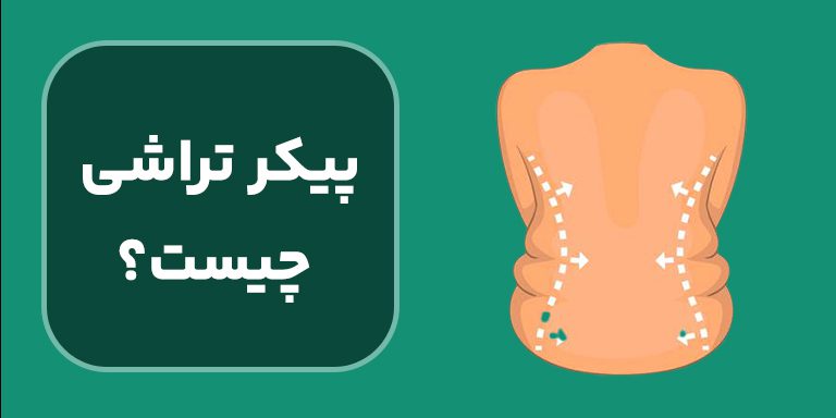 پیکر تراشی چیست؟ انواع پیکر تراشی