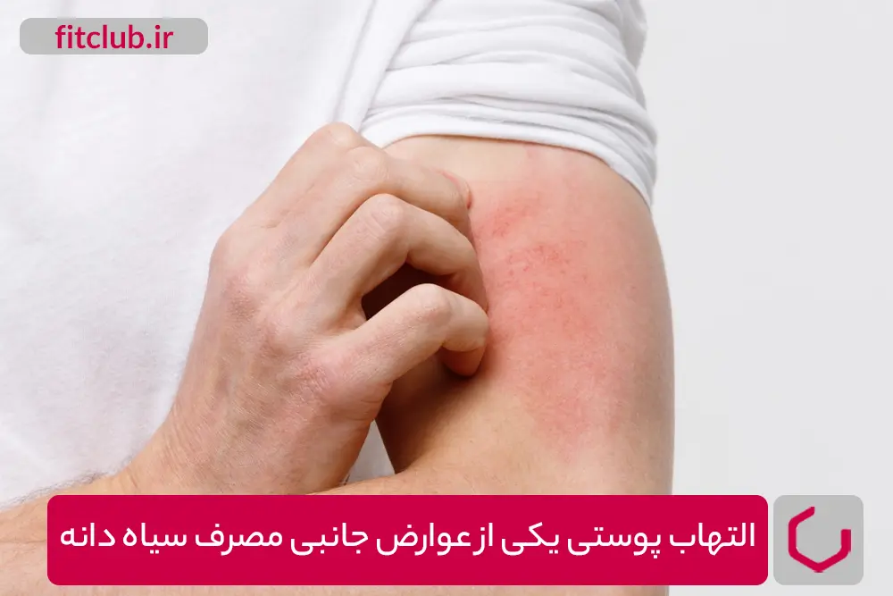 التهاب پوستی یکی از عوارض جانبی مصرف سیاه دانه