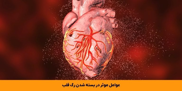 عوامل موثر در بسته شدن رگ قلب