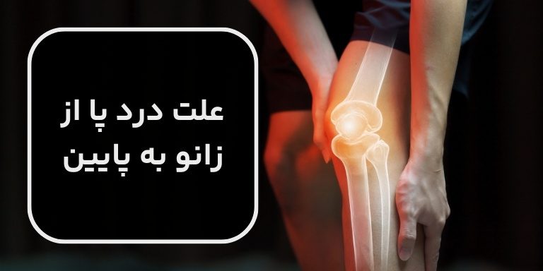 علت درد پا از زانو به پایین