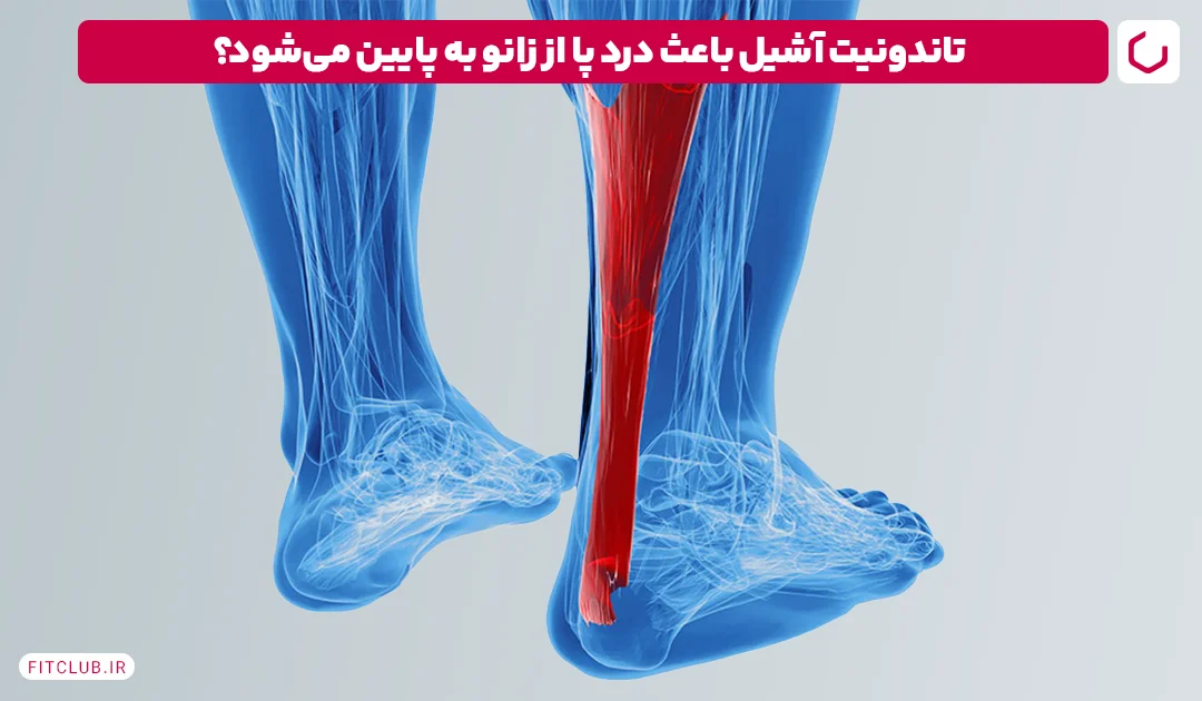 تاندونیت آشیل از دلایل درد پا زانو به پایین | فیت کلاب