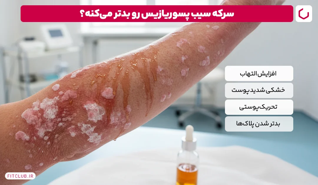 چه کسانی نباید سرکه سیب بخورند؛ افراد مبتلا به مشکلات پوستی | فیت کلاب