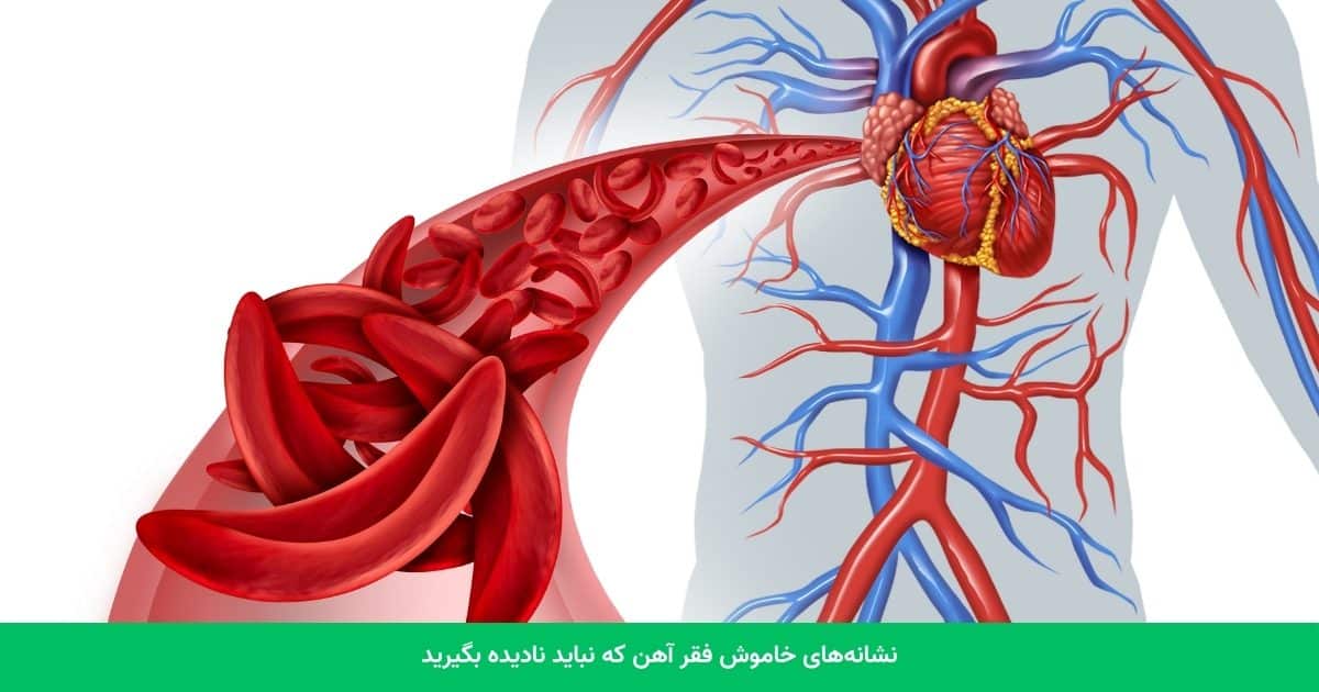 نشانه‌های خاموش فقر آهن که نباید نادیده بگیرید